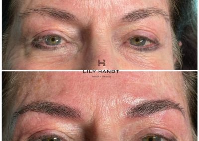 eyebrow microblading before and after