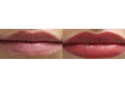 lip shading semi-permanent make up